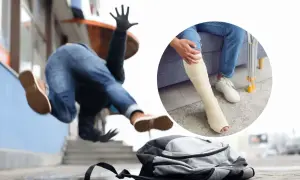 Upadek na drodze do pracy, skutkujący złamaną nogą w gipsie i kulami. Czy należy się odszkodowanie?